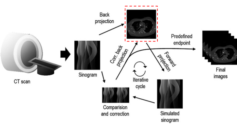 An overview of an iterative reconstruction algorithm. From the measured projections a reconstructed image is estimated. This image is then iteratively compared with the original sinogram in the forward projection and corrected until a predefined endpoint. Figure reproduced from 